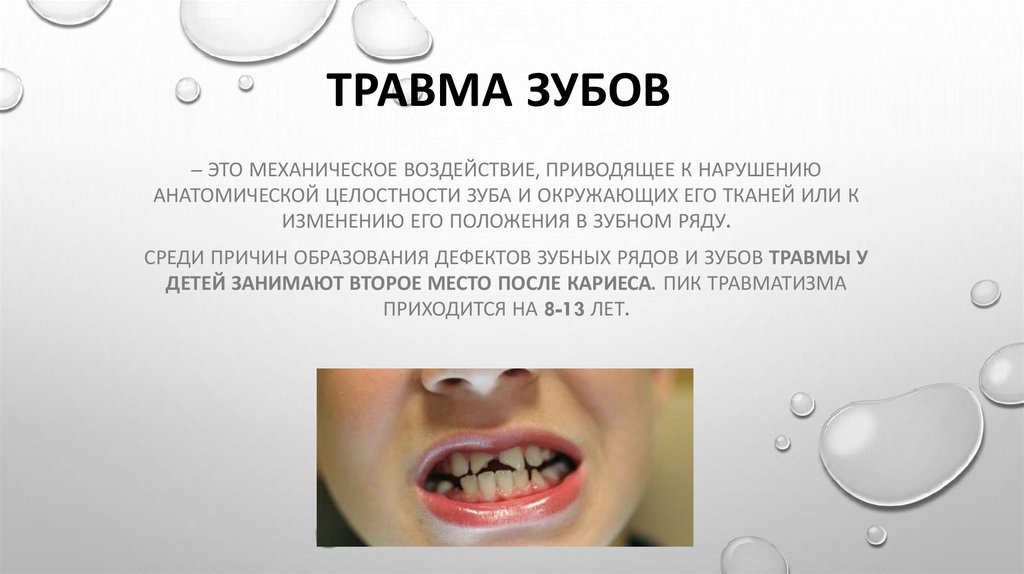 Травма зубов