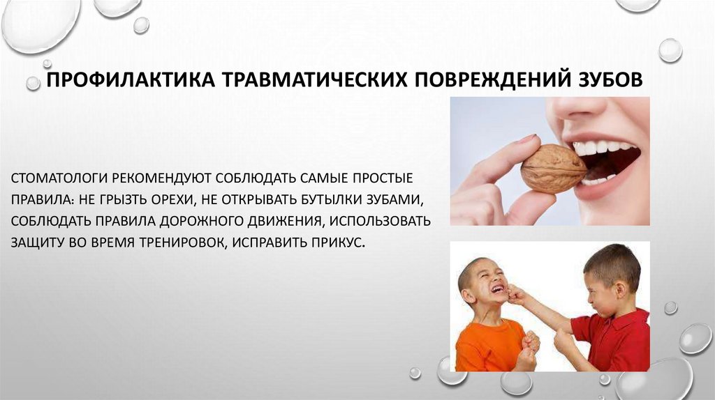 Профилактика травматических повреждений зубов