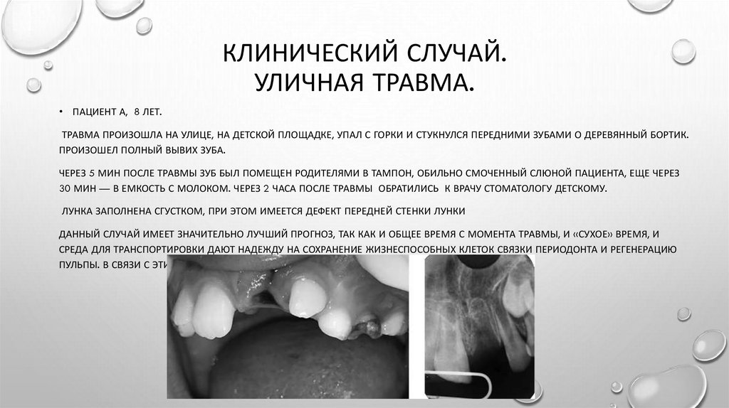 Клинический случай. Уличная травма.