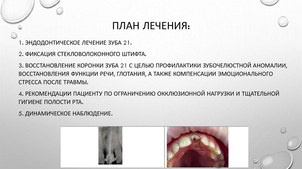 план лечения: