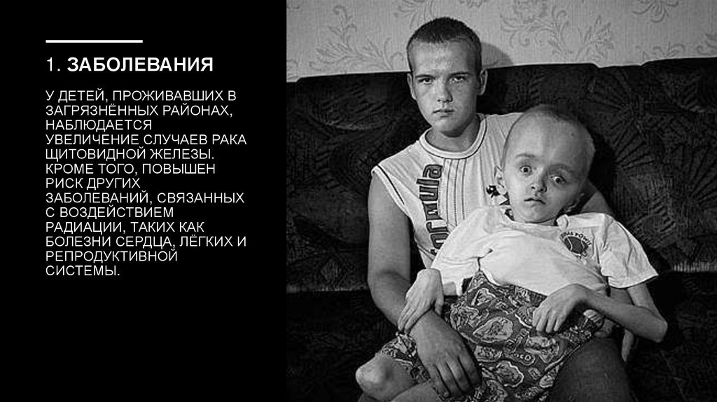1. Заболевания У детей, проживавших в загрязнённых районах, наблюдается увеличение случаев рака щитовидной железы. Кроме того,