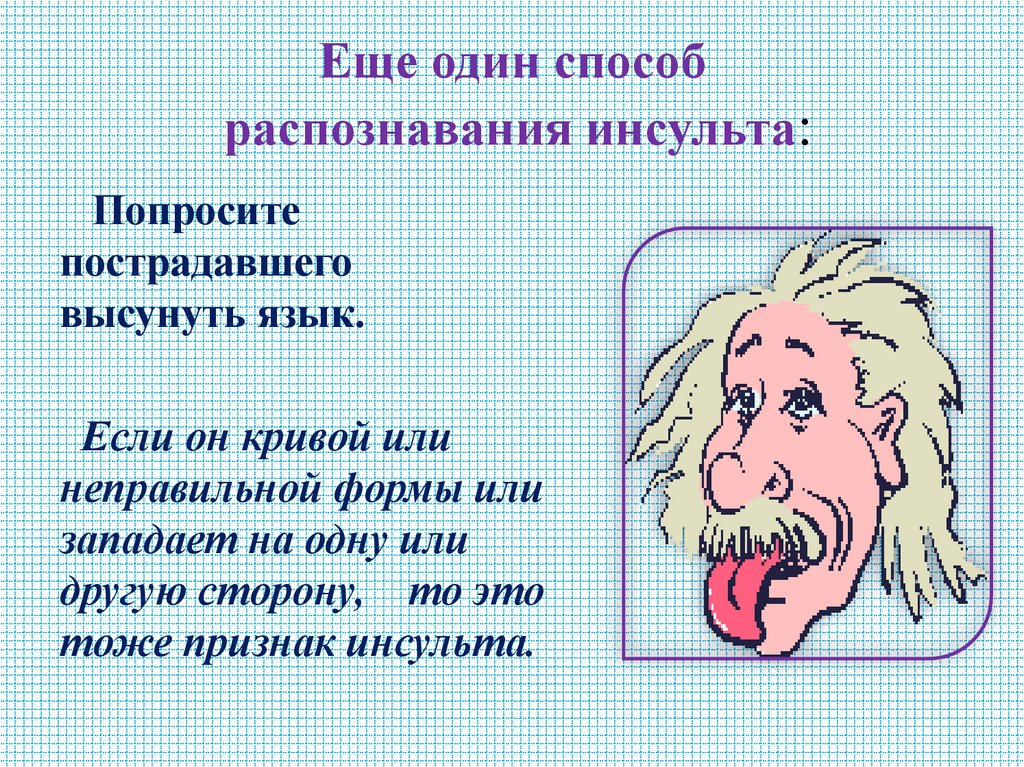 Еще один способ распознавания инсульта: