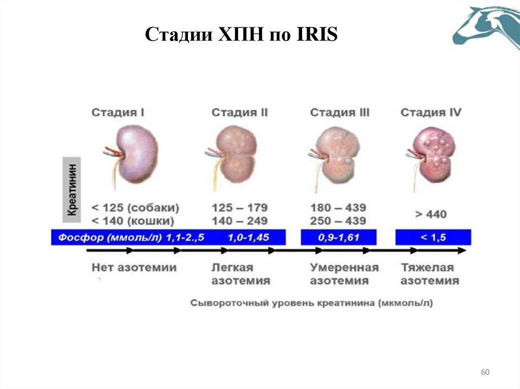 Стадии ХПН по IRIS