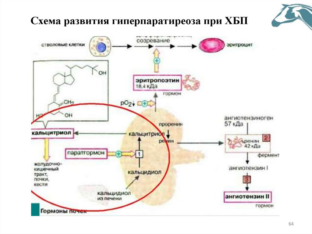 Схема развития гиперпаратиреоза при ХБП