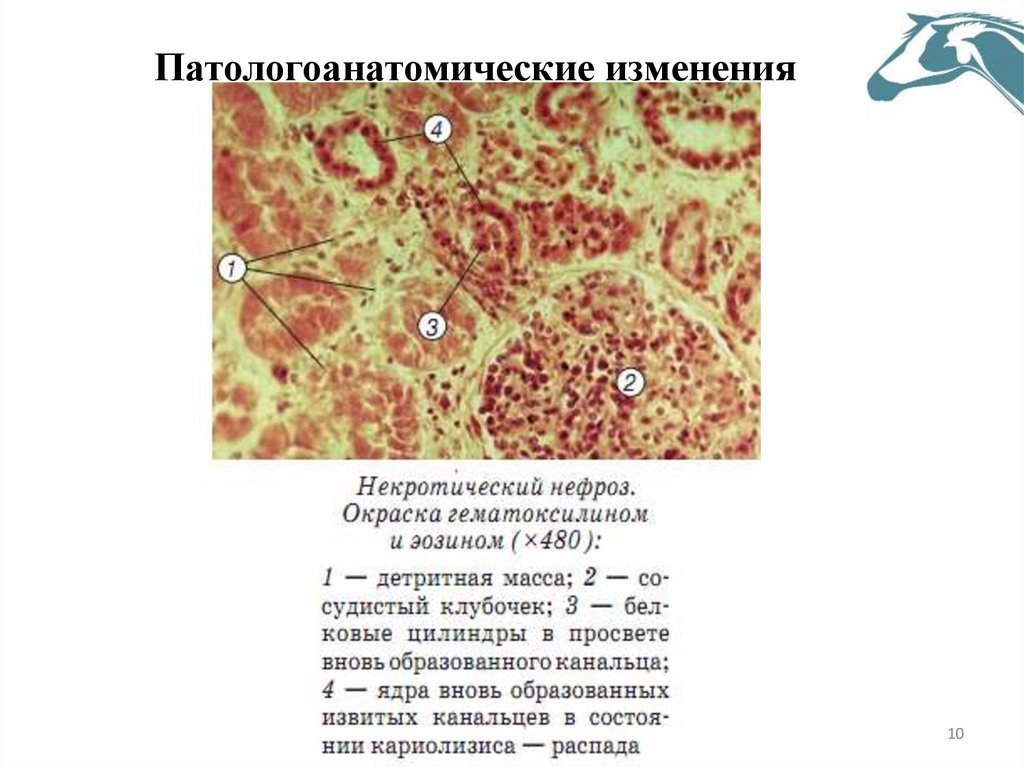 Патологоанатомические изменения