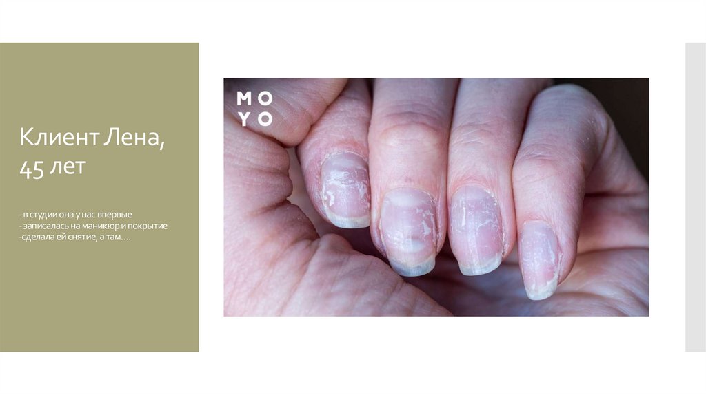 Клиент Лена, 45 лет - в студии она у нас впервые - записалась на маникюр и покрытие -сделала ей снятие, а там….