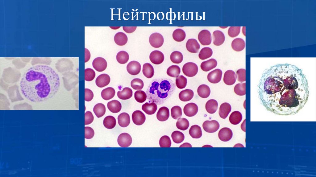 Нейтрофилы