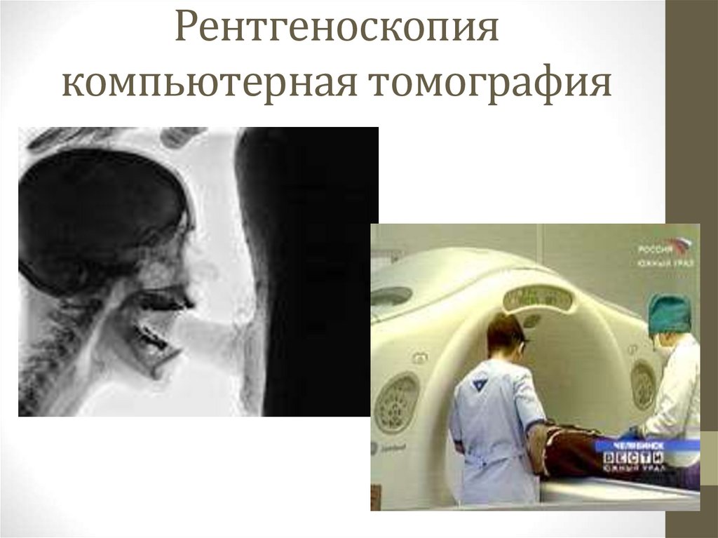 Рентгеноскопия компьютерная томография