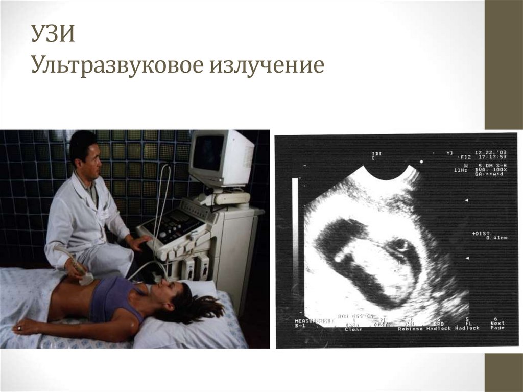 УЗИ Ультразвуковое излучение