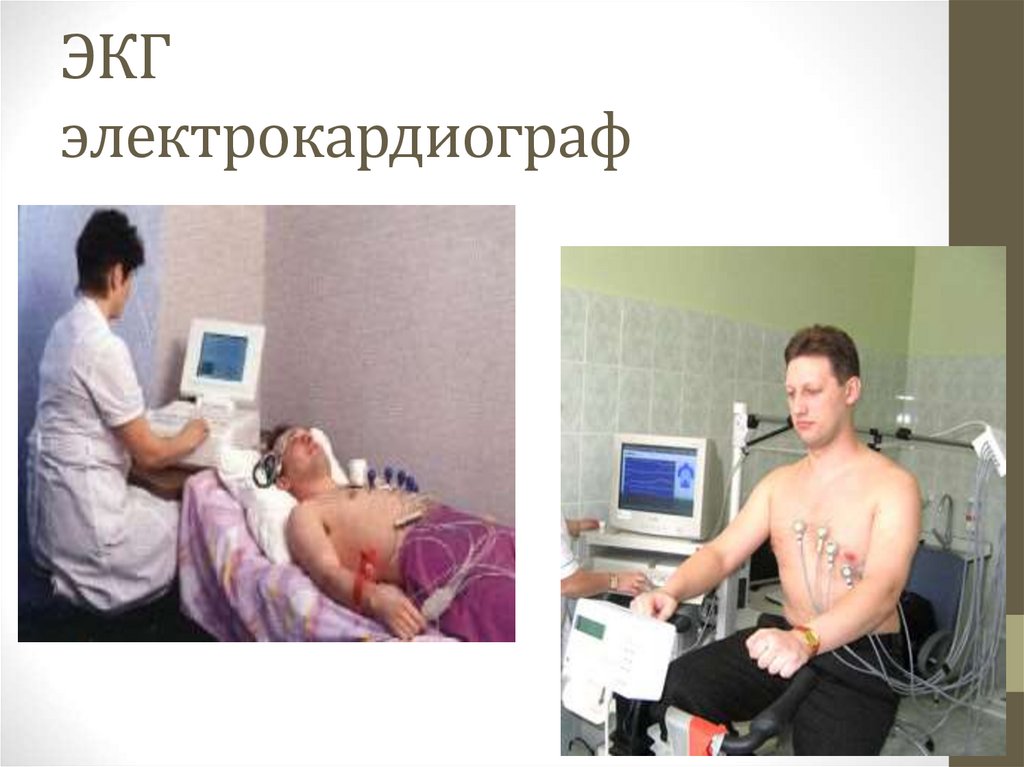 ЭКГ электрокардиограф