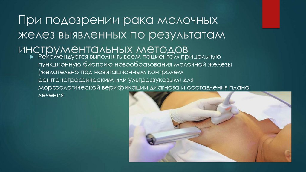 При подозрении рака молочных желез выявленных по результатам инструментальных методов
