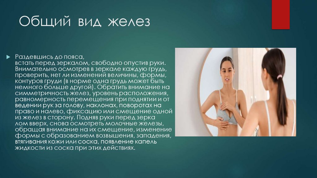 Общий  вид  желез