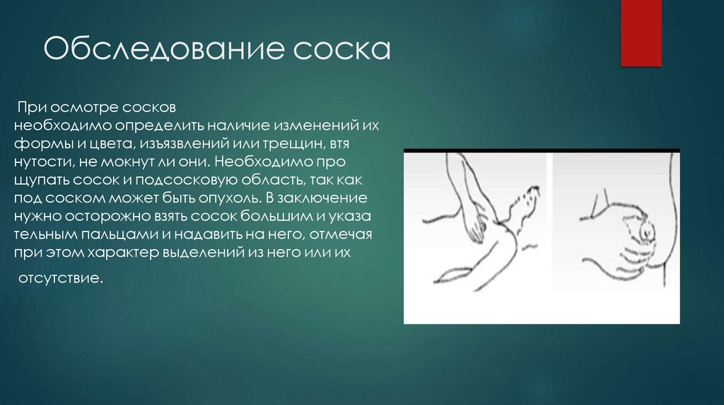 Обследование соска