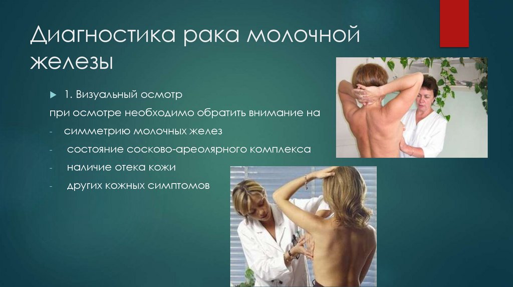 Диагностика рака молочной железы