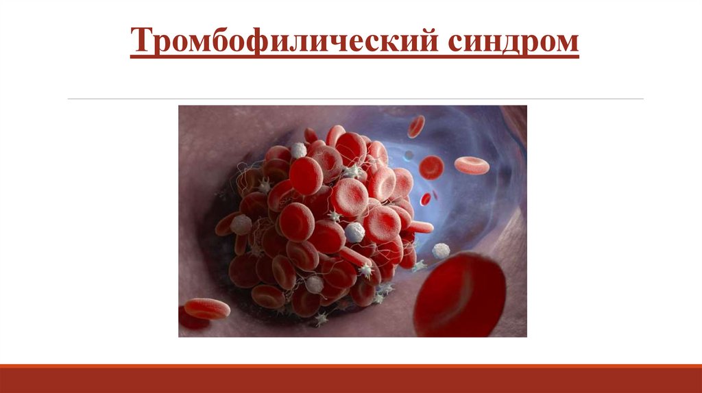 Тромбофилический синдром