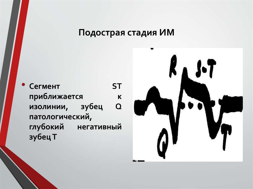 Подострая стадия ИМ