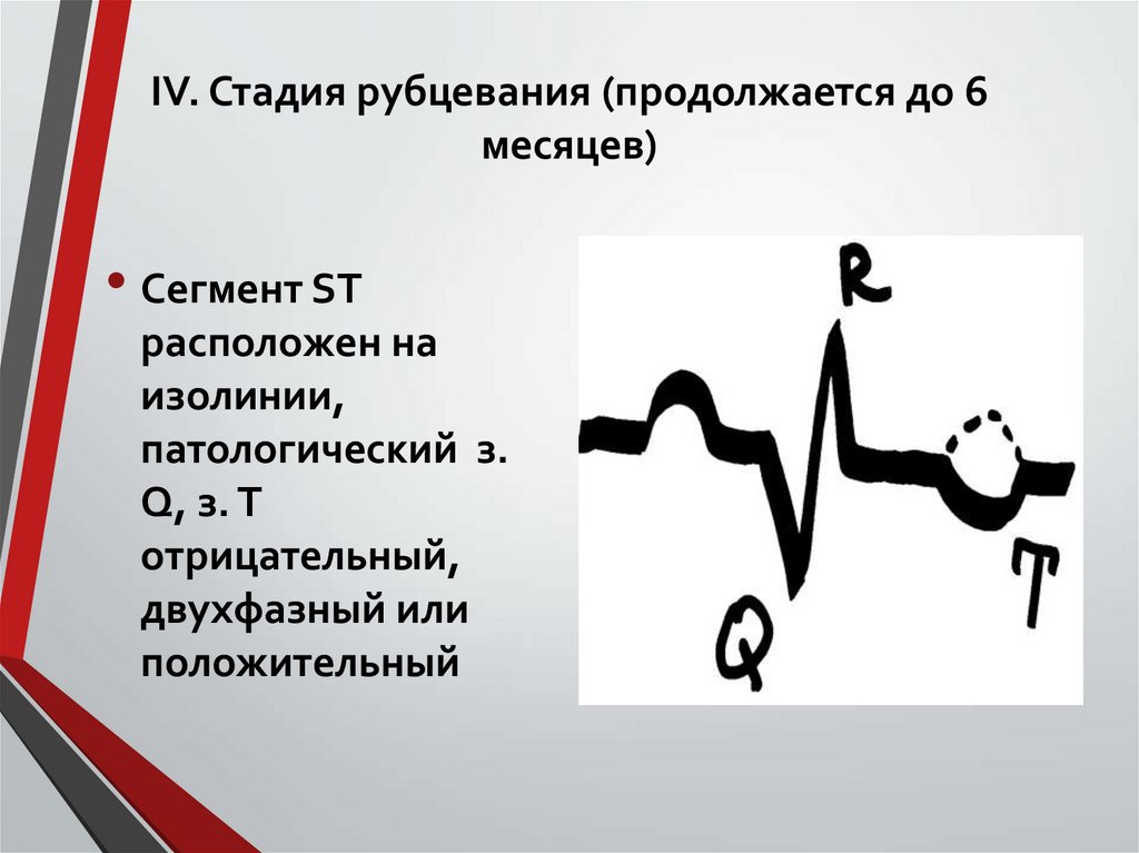 ІV. Стадия рубцевания (продолжается до 6 месяцев)