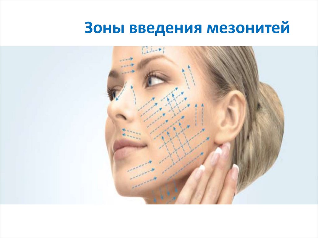 Зоны введения мезонитей