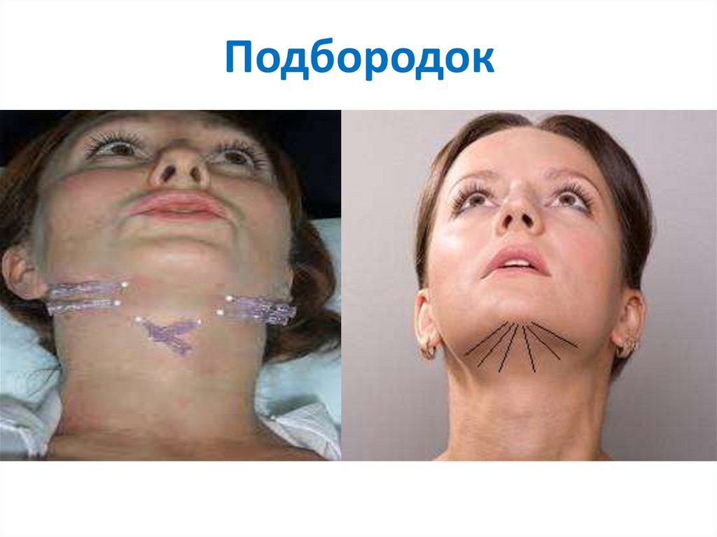 Подбородок