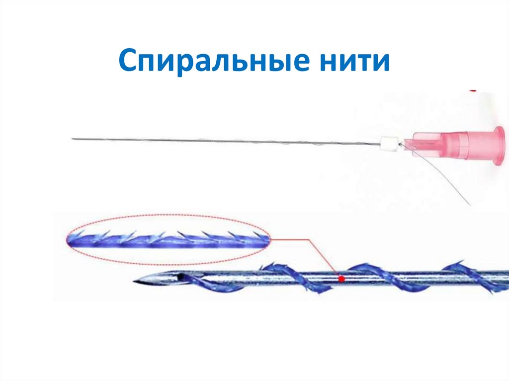 Спиральные нити