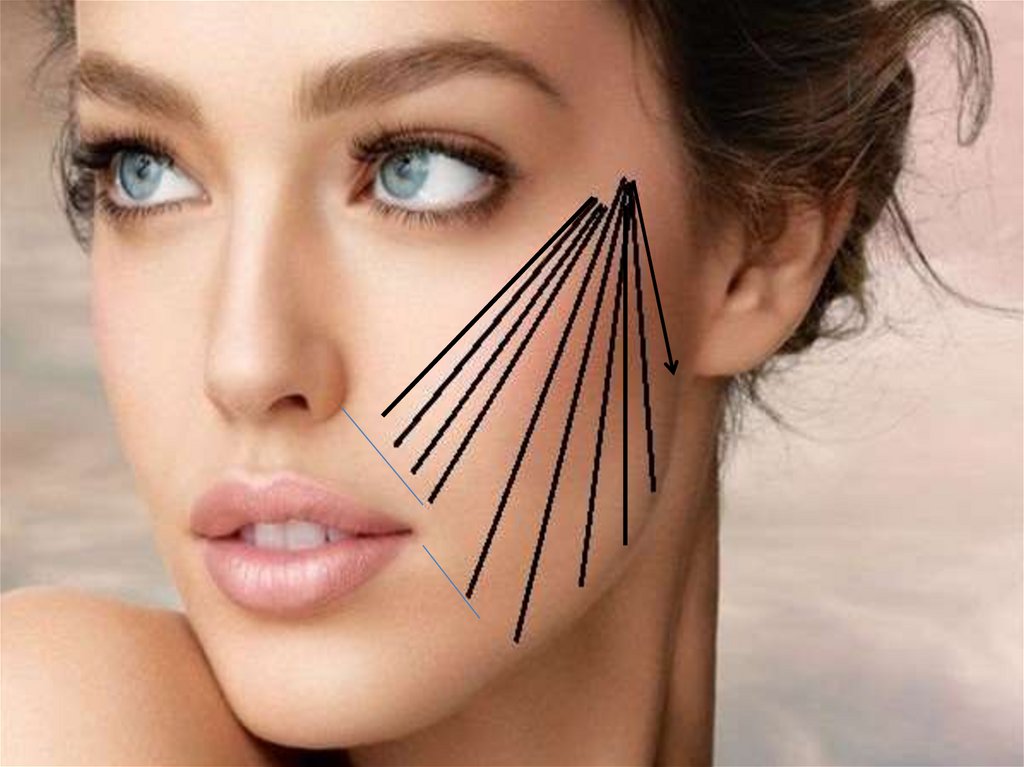 Спиральные мезонити