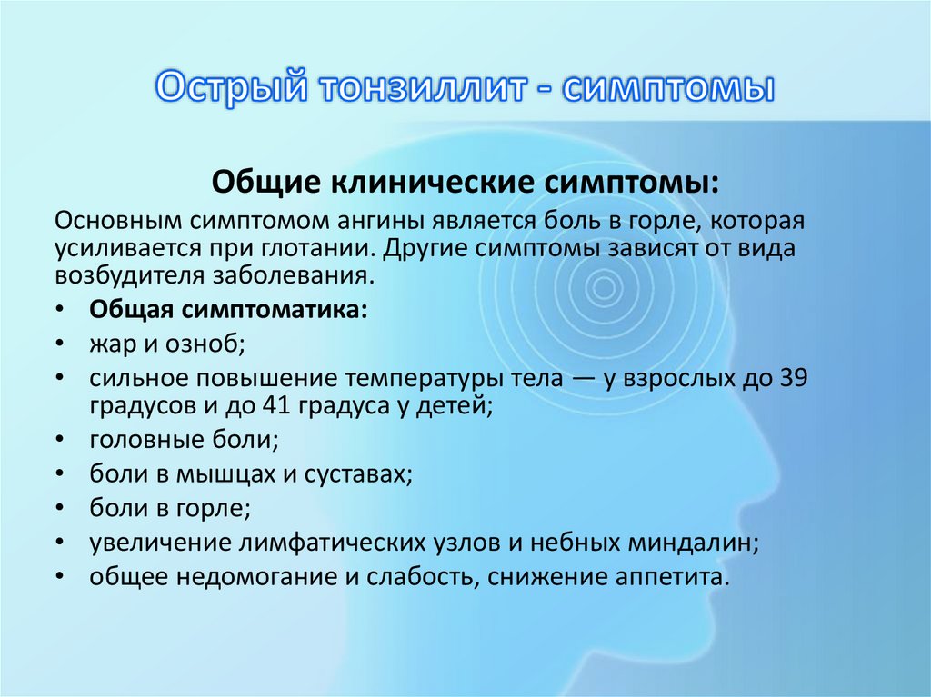 Острый тонзиллит - симптомы