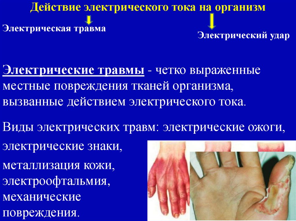 Действие электрического тока на организм