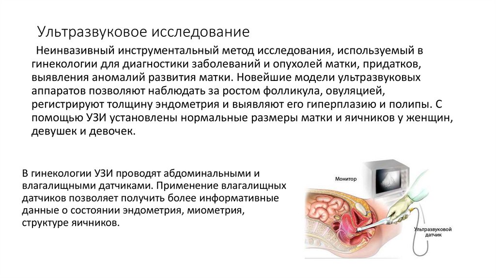 Ультразвуковое исследование