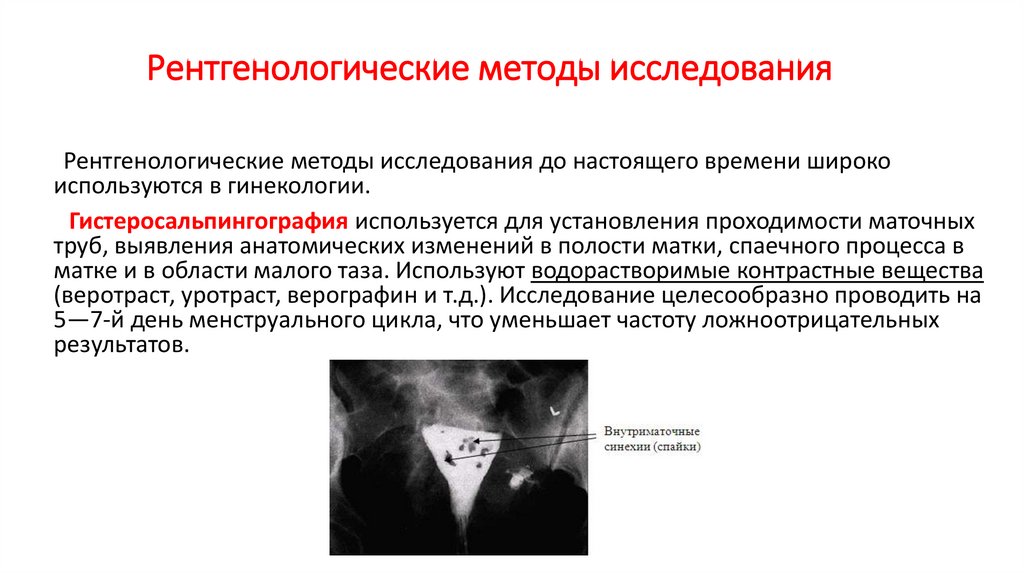 Рентгенологические методы исследования