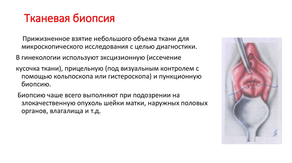 Тканевая биопсия