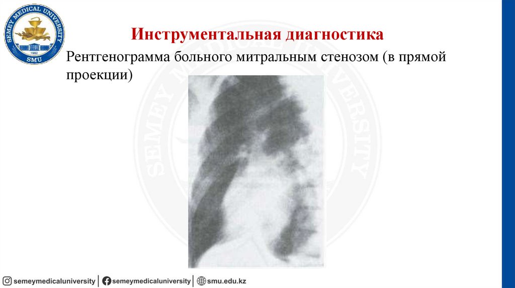 Инструментальная диагностика