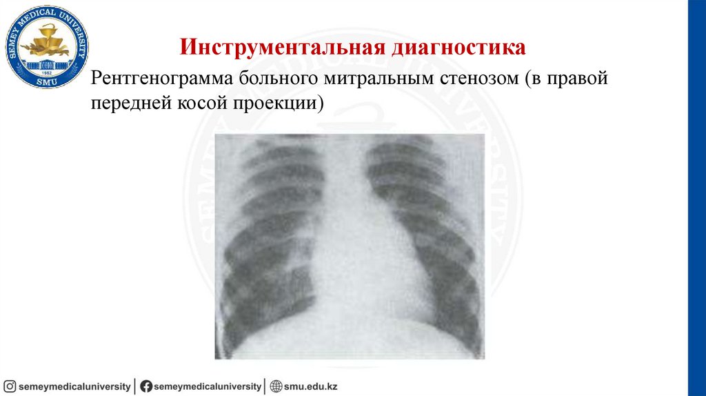 Инструментальная диагностика