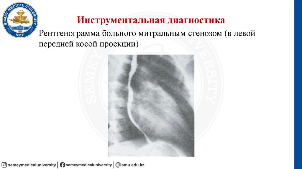 Инструментальная диагностика
