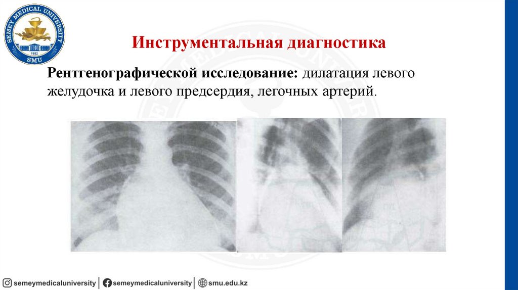 Инструментальная диагностика