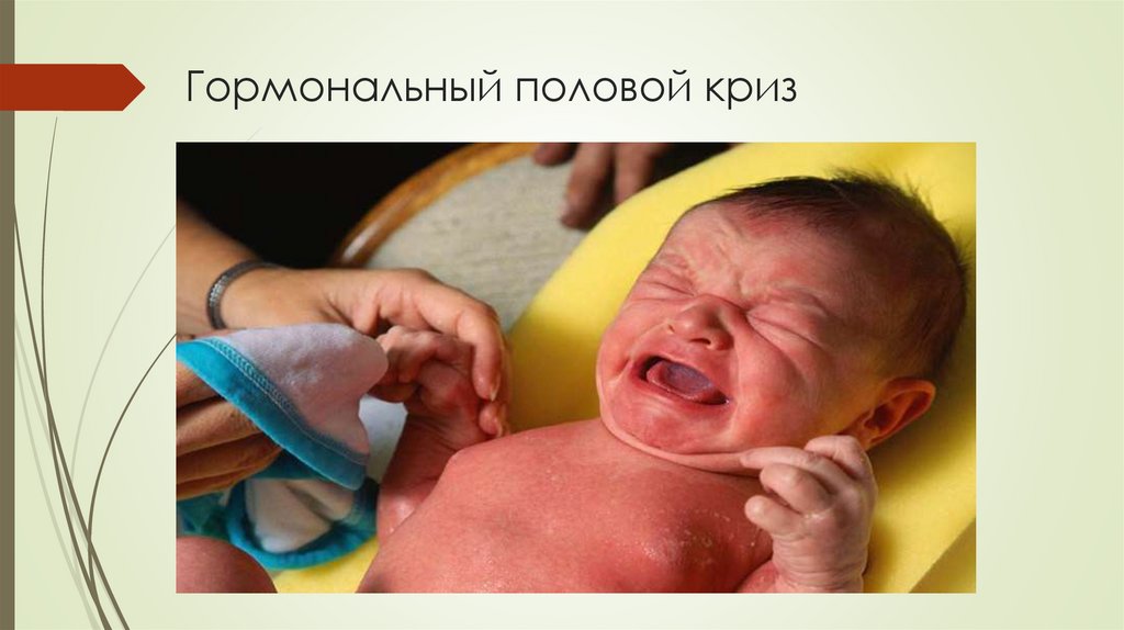 Гормональный половой криз