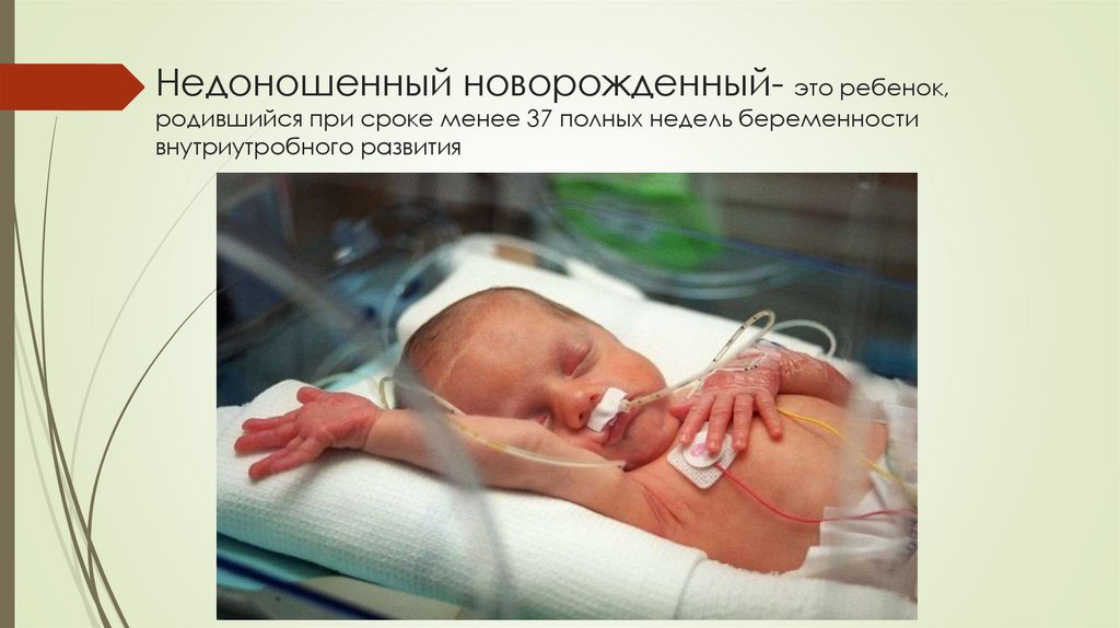Недоношенный новорожденный- это ребенок, родившийся при сроке менее 37 полных недель беременности внутриутробного развития