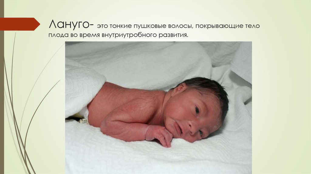 Лануго- это тонкие пушковые волосы, покрывающие тело плода во время внутриутробного развития.