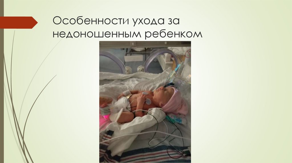 Особенности ухода за недоношенным ребенком