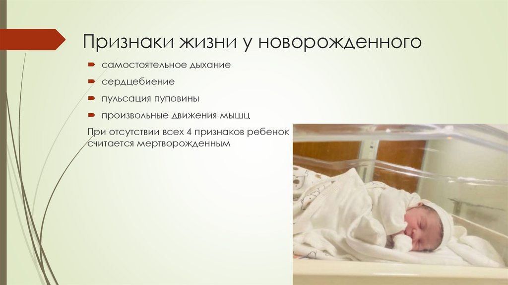 Признаки жизни у новорожденного