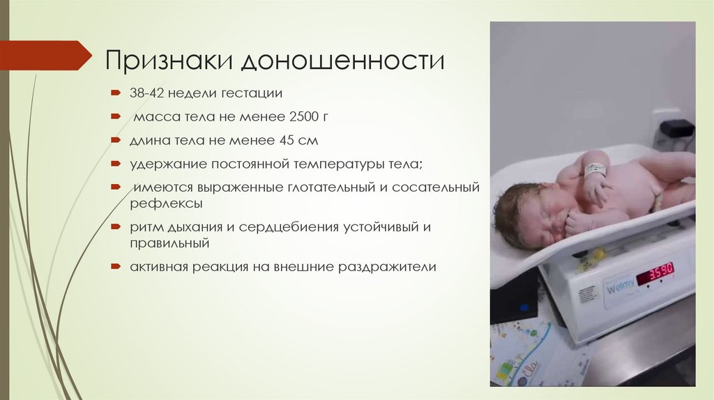 Признаки доношенности