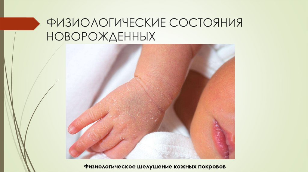 ФИЗИОЛОГИЧЕСКИЕ СОСТОЯНИЯ НОВОРОЖДЕННЫХ