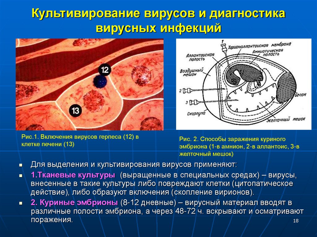 Культивирование вирусов и диагностика вирусных инфекций