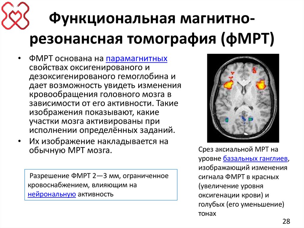 Функциональная магнитно-резонансная томография (фМРТ)