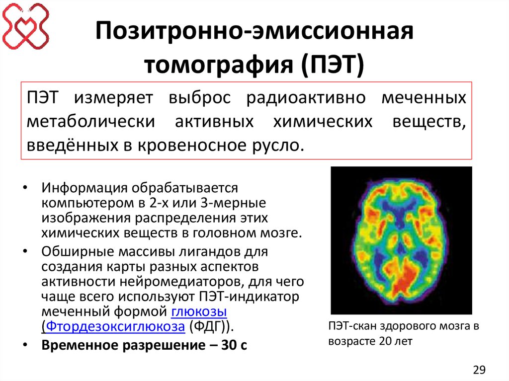 Позитронно-эмиссионная томография (ПЭТ)