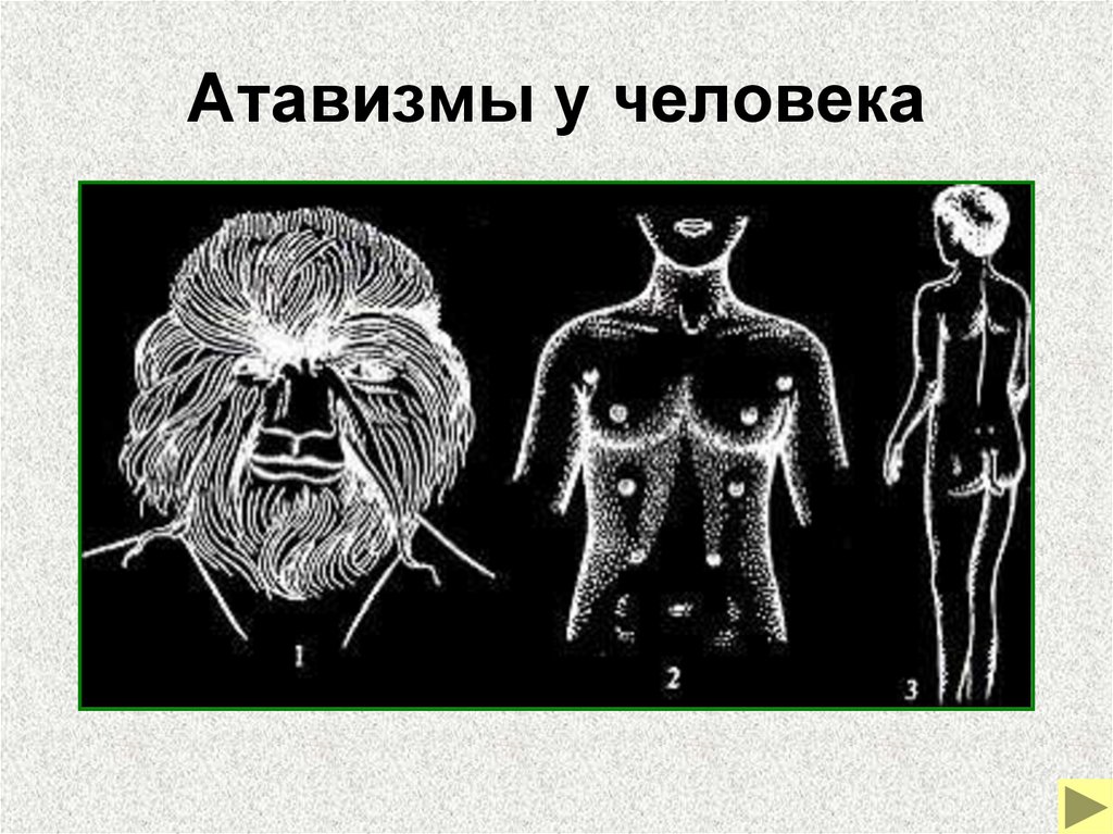 Атавизмы у человека