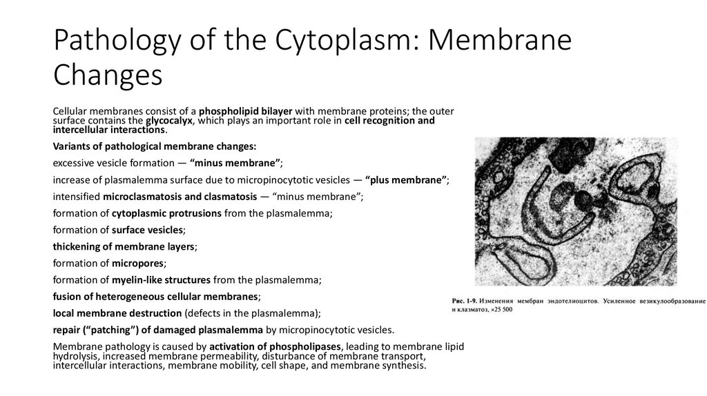 Pathology of the Cytoplasm: Membrane Changes
