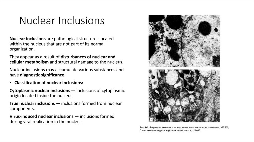 Nuclear Inclusions