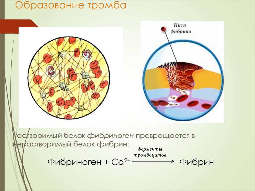 Образование тромба