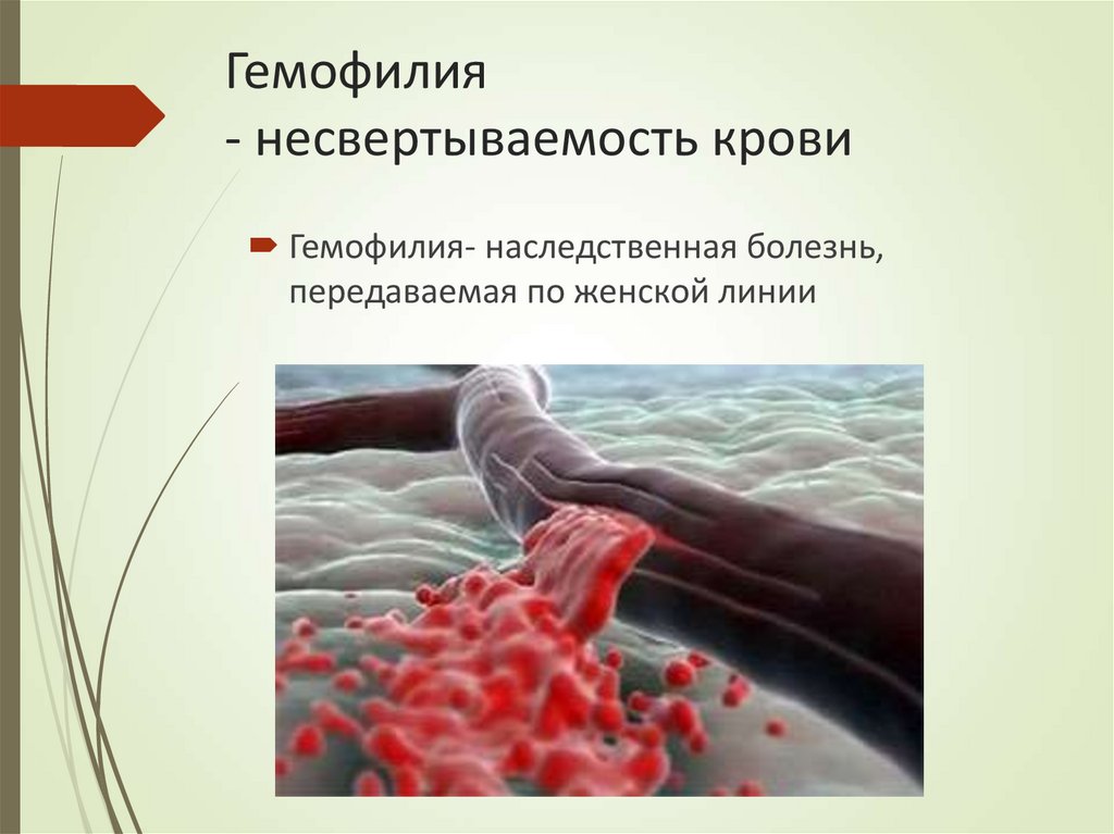 Гемофилия - несвертываемость крови