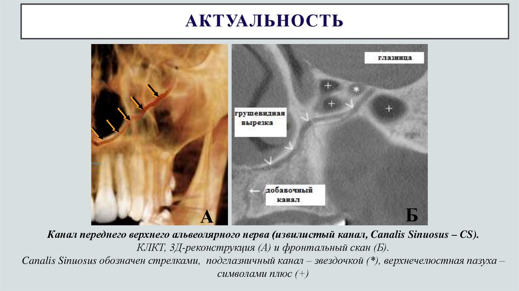АКТУАЛЬНОСТЬ